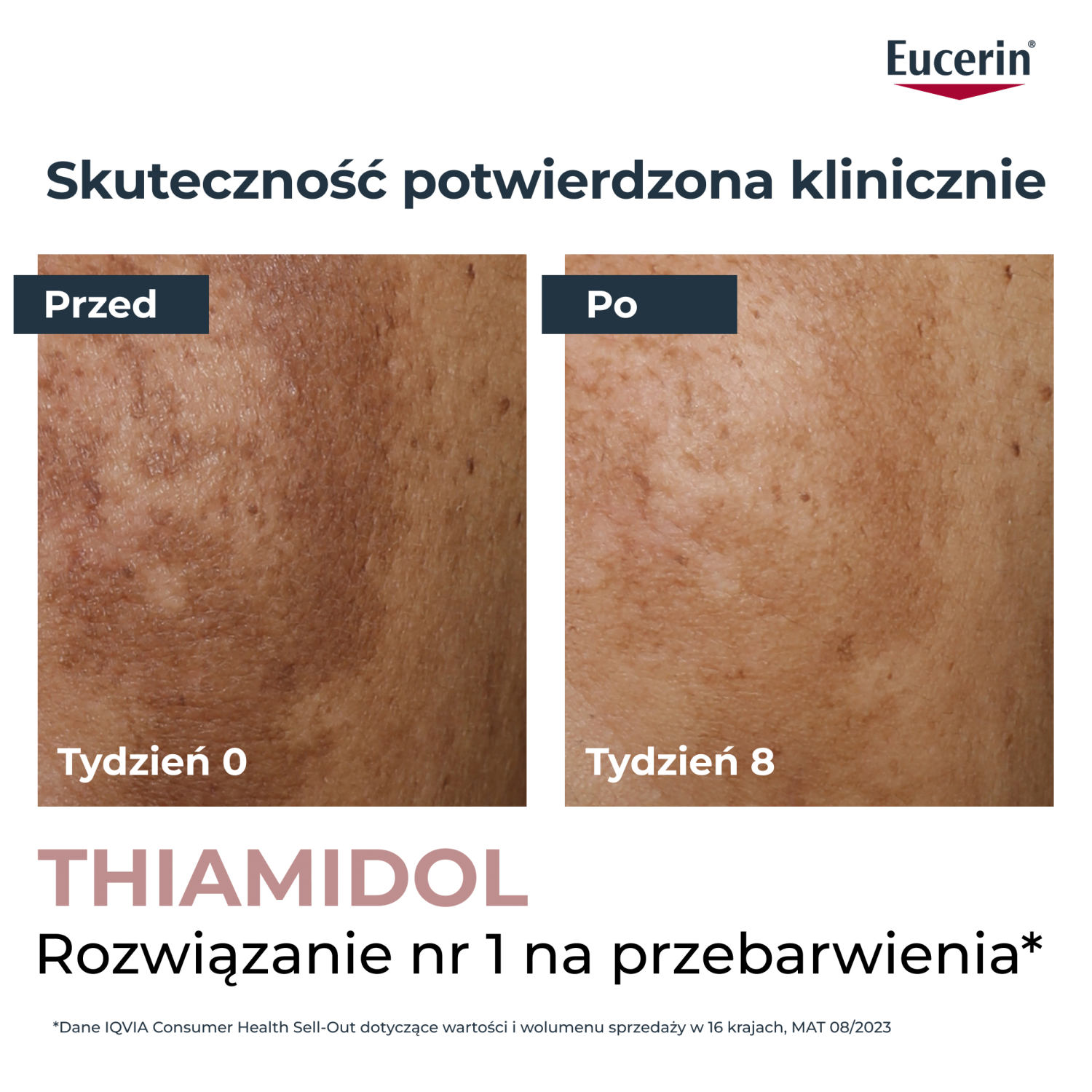 Eucerin Anti-Pigment
