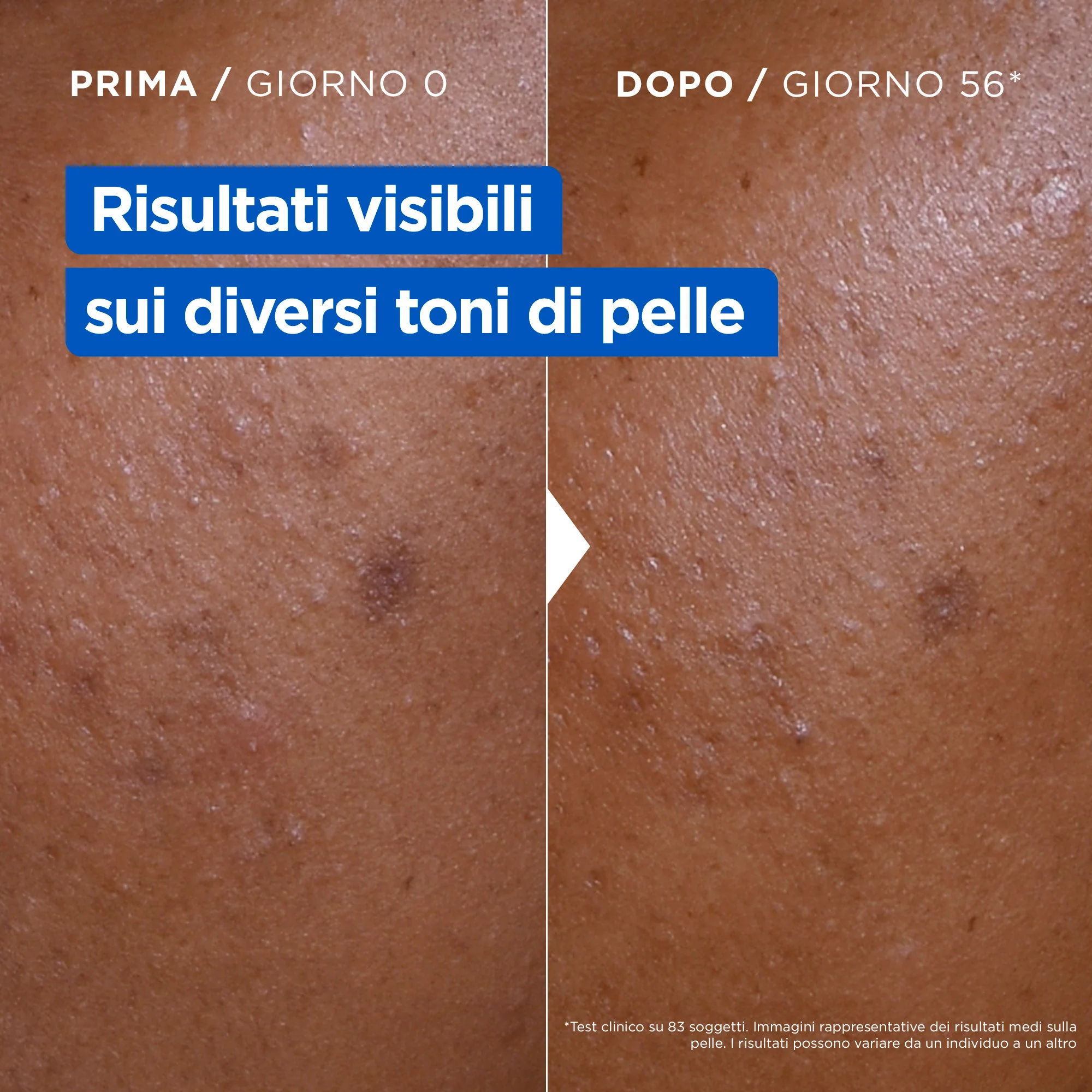 Corpo Niacinamide Bright - Moisturizing - Crema Corpo, Crema corpo illuminante