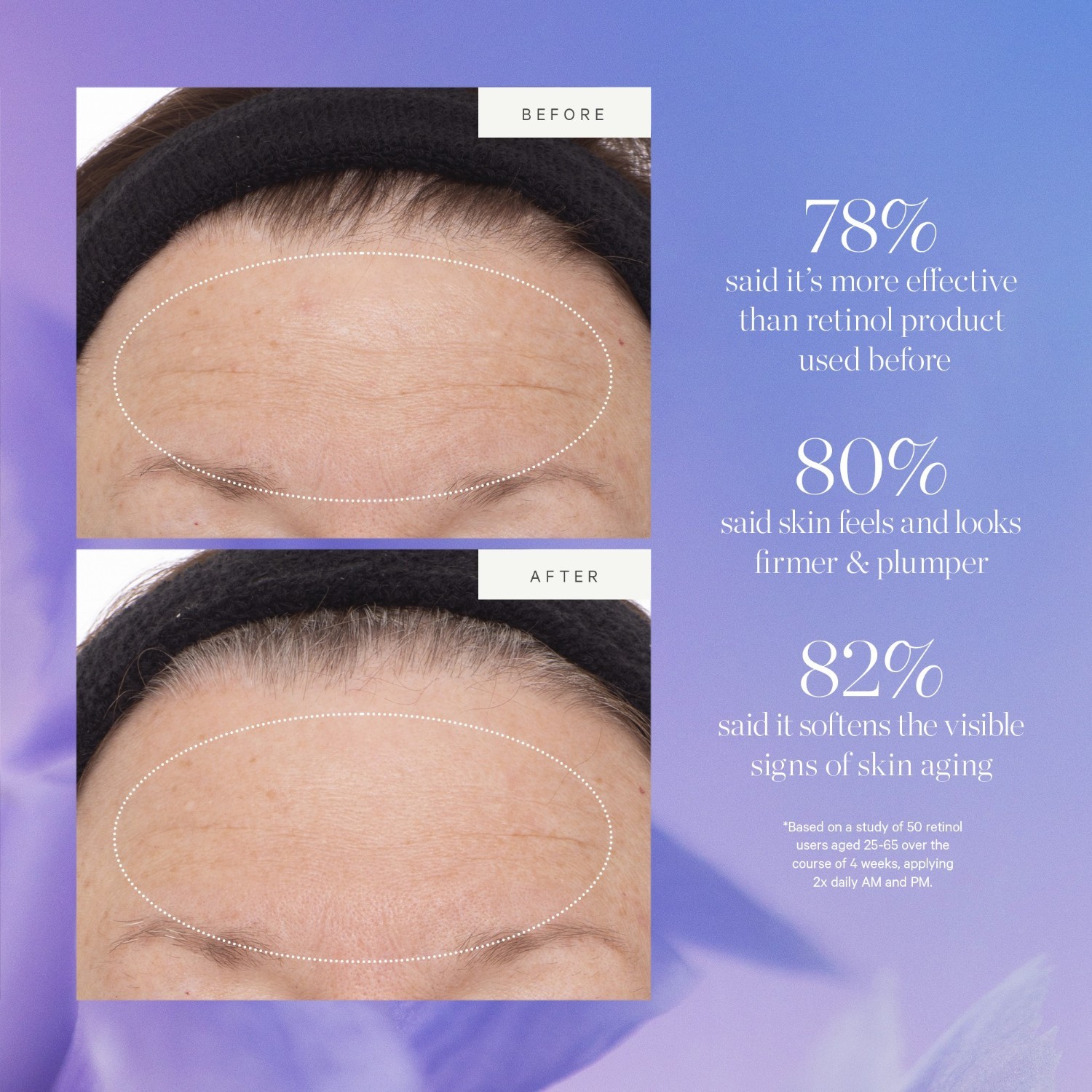 KORA Organics Serum protiv starenja s biljnim matičnim ćelijama i alternativom retinola – 10 ml