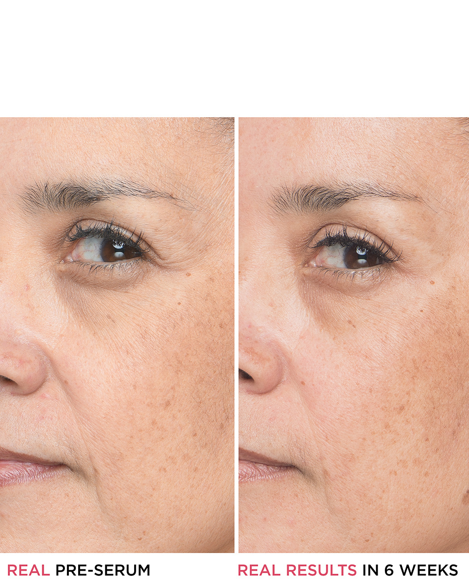 COSMETICE IT SER PENTRU LINII IT SER PENTRU LINII CU ACID HIALURONIC