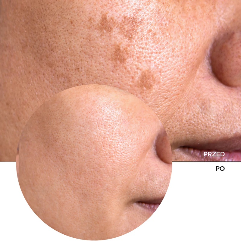 „Revox B77 JUST“ vitamino C 20 % antioksidacinis serumas su vitaminu C