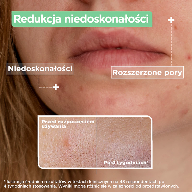Mixa LAB Expert Serum für Problemhaut