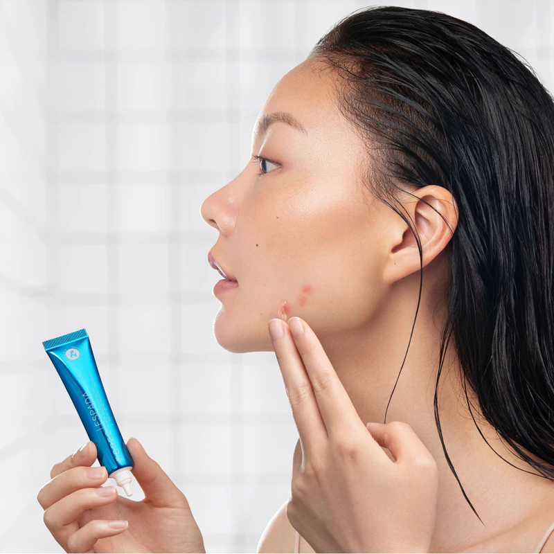 FOREO ESPADA™ BHA+PHA Blemish Solution gel tópico para acne