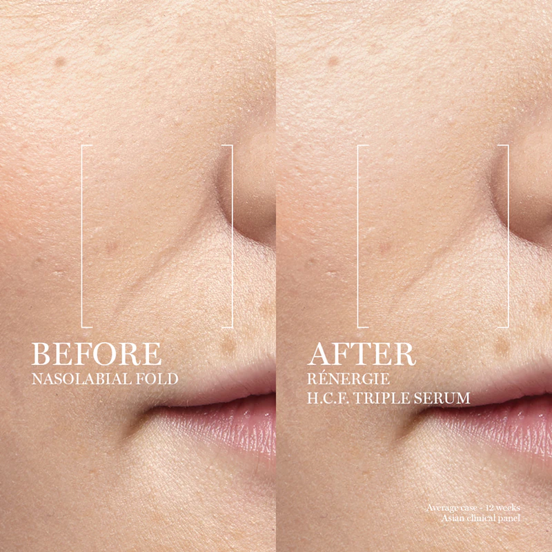 Pleťové sérum Lancôme Rénergie HCF Triple Serum