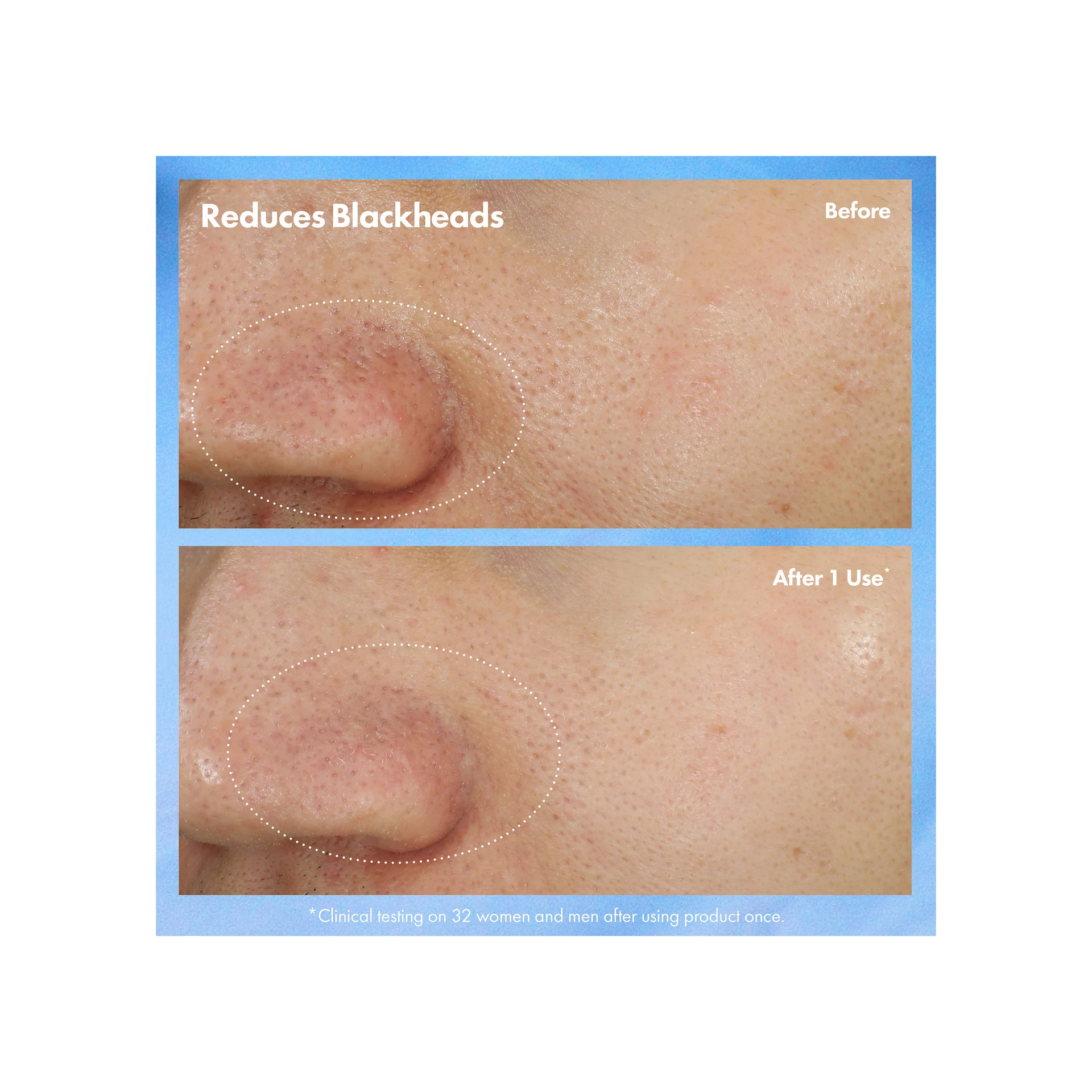 Clear Improvement mitesszer tisztító maszk-radír 75 ml - Origins
