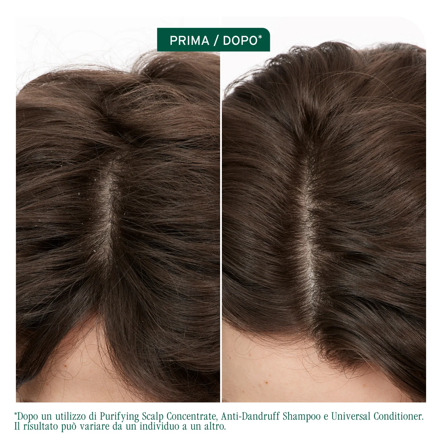 Scalp Sync Shampoo Anti-Dandruff - Shampoo Antiforfora