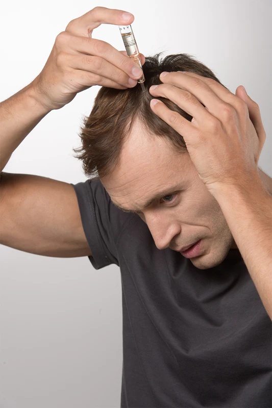 Crescina Transdermic 500 tretma za ponovno rast in preprečevanje izpadanja las za moške, ki podpira rast las in preprečuje izpadanje las.