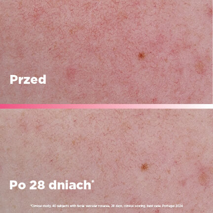 Bioderma Sensibio