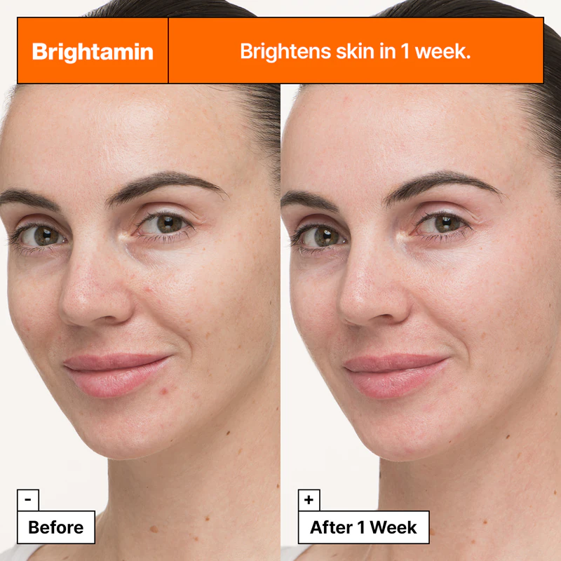 Dr. Jart+ Brightamin Sérum Clareador Ampola: sérum ativo clareador e suavizante com vitamina C.