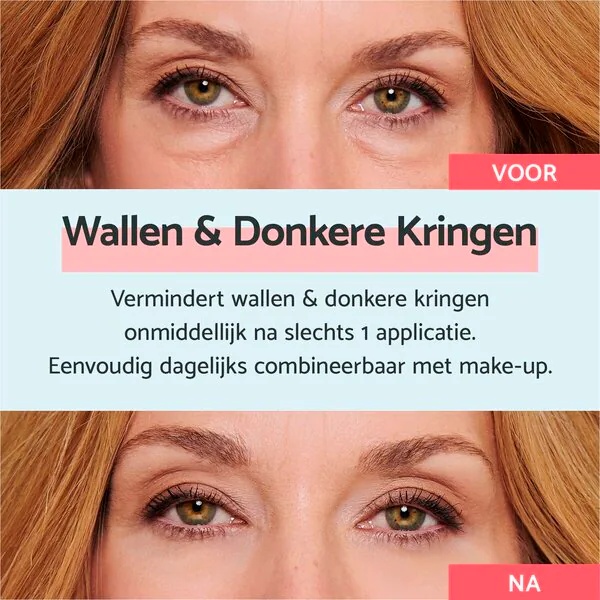„Remescar“ paakių kremas nuo maišelių ir tamsių ratų<br>8 ml – visiems odos tipams