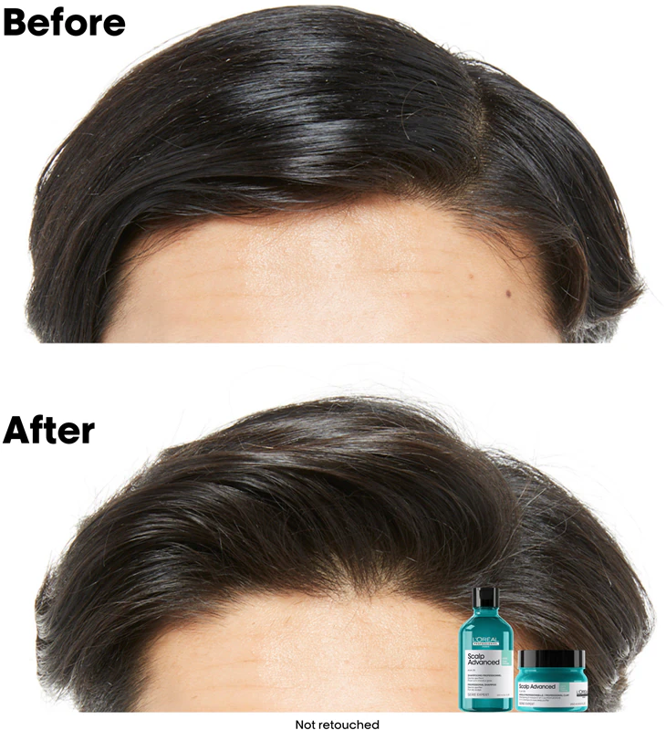 L'Oréal Professionnel Serie Expert Scalp Advanced 2-in-1 Shampoo und Maske für fettiges Haar und fettige Kopfhaut