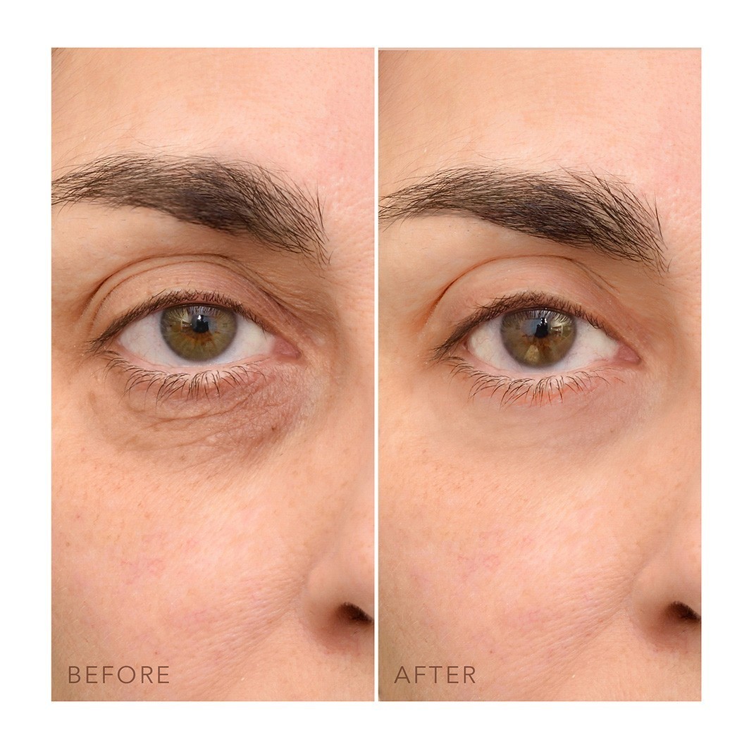 FOREO serum za oči IRIS™ C koncentrirana krema za oči - 15 ml