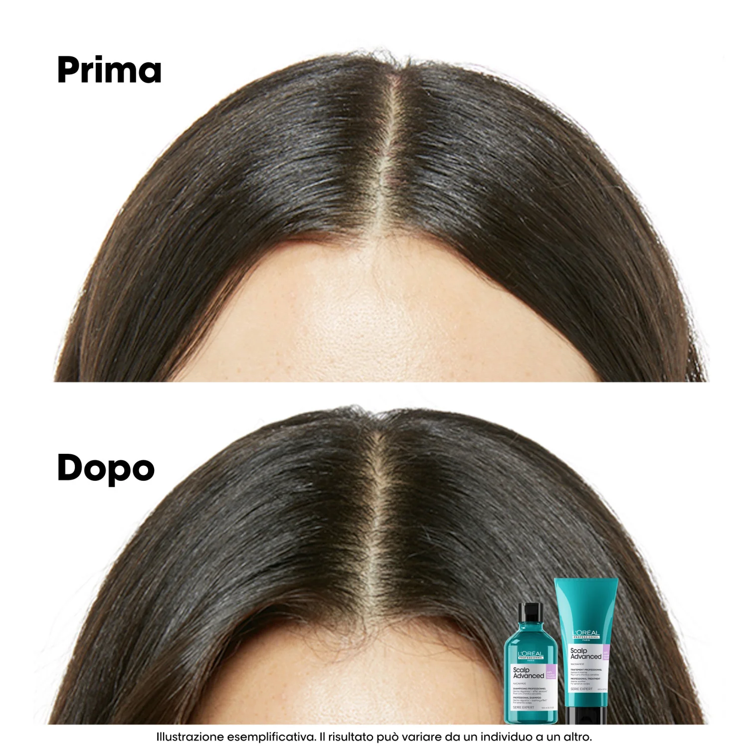 SERIE EXPERT New Scalp Advanced Shampoo Anti-Discomfort - Refill - Shampoo Purificante, Shampoo Detossinante