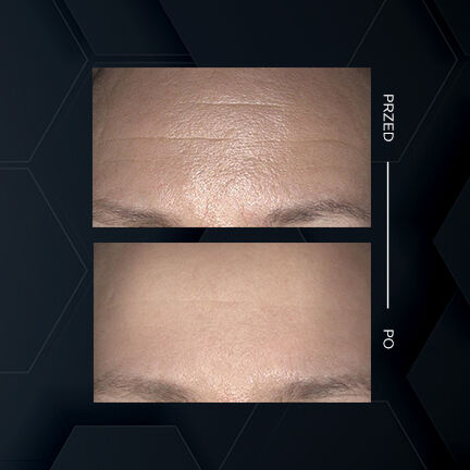 SKINARTÉ AGELESS