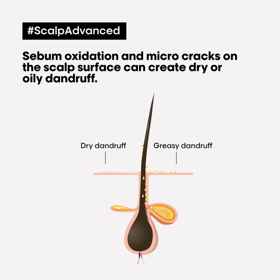 L'Oréal Professionnel Hair Shampoo Scalp Advanced Anti-Dandruff Dermo-Clarifier – 300 ml