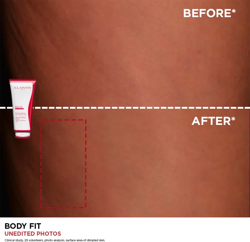 „Clarins Body Fit Skin Smoothing Expert“ stangrinamasis kremas nuo celiulito