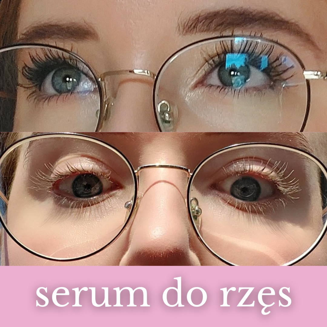 Nachemii serum za trepalnice