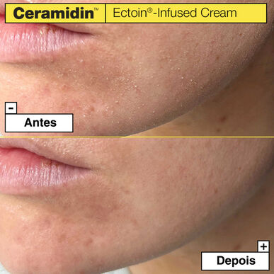 Dr. Jart Ceramidin Ectoin-Infused Cream Skoncentrowany krem nawilżający do twarzy z 5 ceramidami, 50 ml