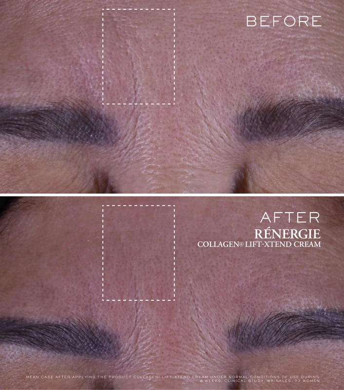 Lancôme Rénergie Collagen+ Lift-Xtend Cream creme facial com colágeno