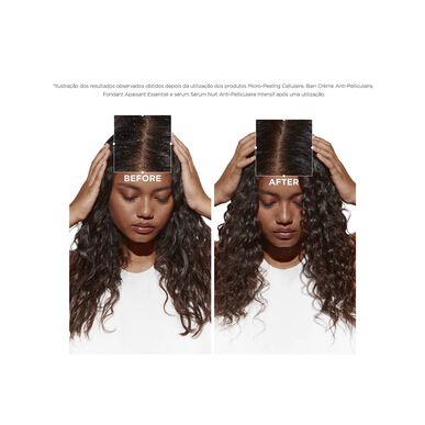 Kérastase Symbiose Bain Crème Anti-Pelliculaire Purifying Anti-Dandruff Shampoo kuiville hiuksille 250 ml 250 ml