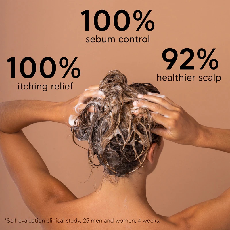 Apivita Dandruff Oily Dandruff Shampoo šampon proti prhljaju za mastne lase