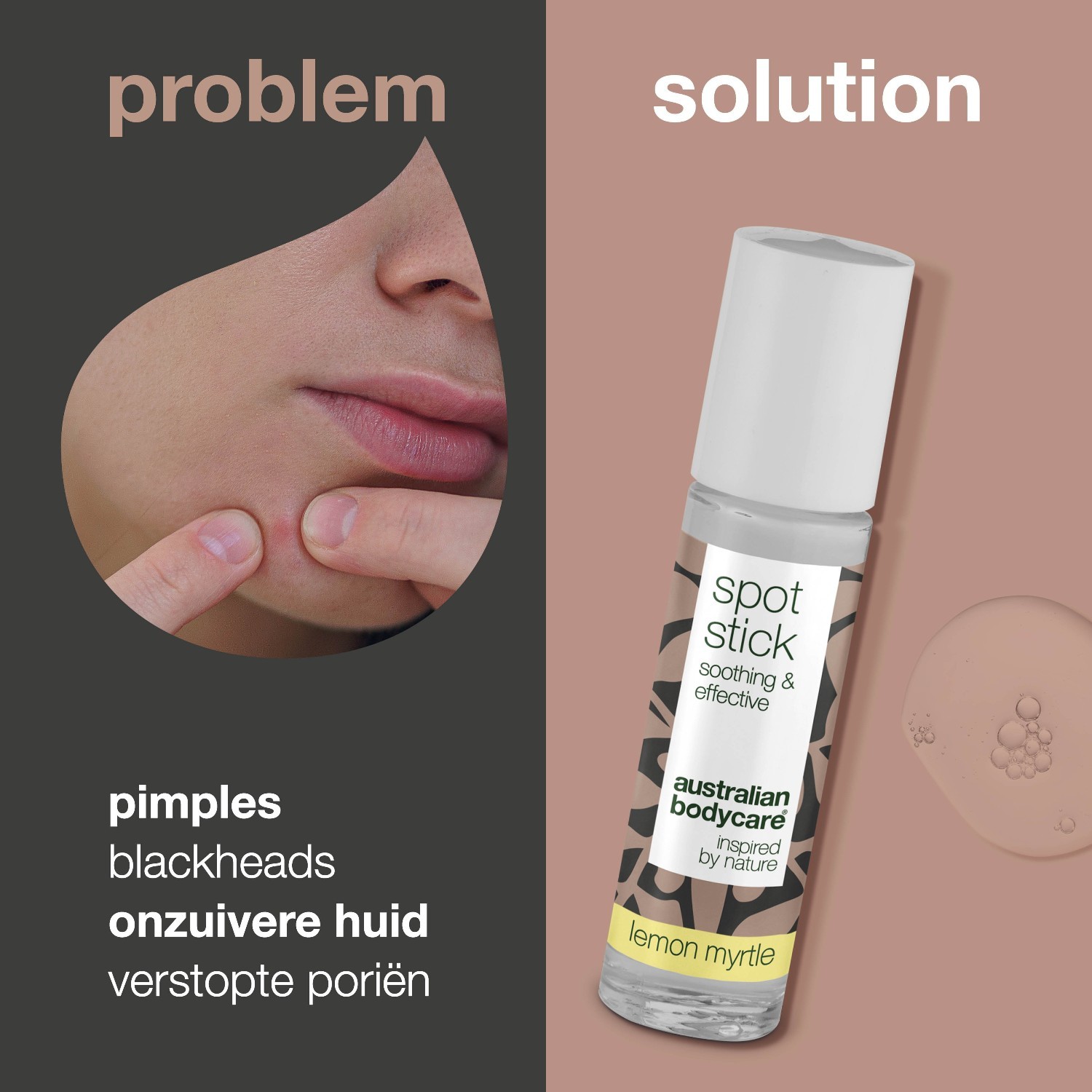 Australian Bodycare Anti-Pickel-Pflegestift Zitronenmyrte – 9 ml