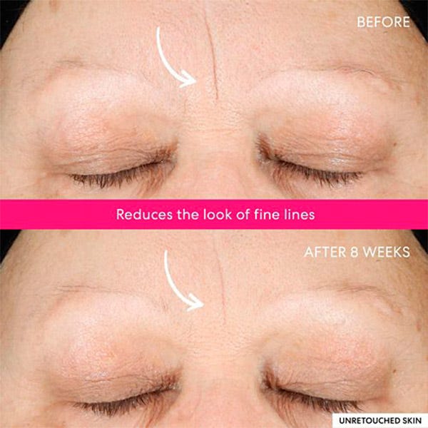 Ageless Phyto-Aha Ladiance Πίλινγκ Προσώπου | 50ml