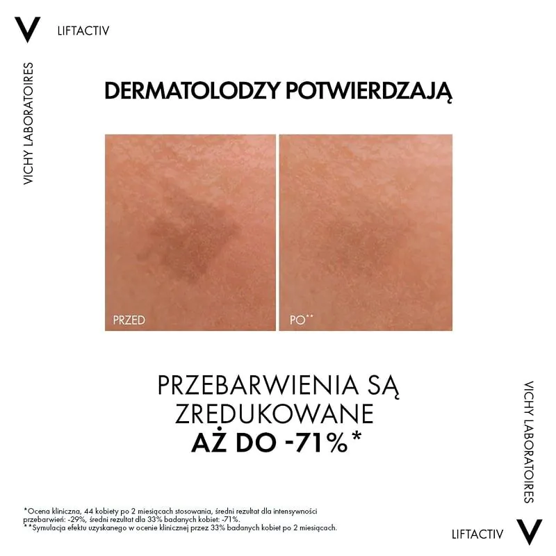 Vichy Liftactiv Specialist B3 Serum redukujące przebarwienia i zmarszczki z 5% niacynamidu