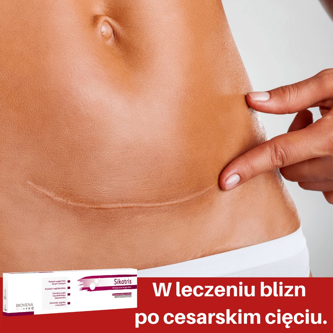 Biovena Sikatris