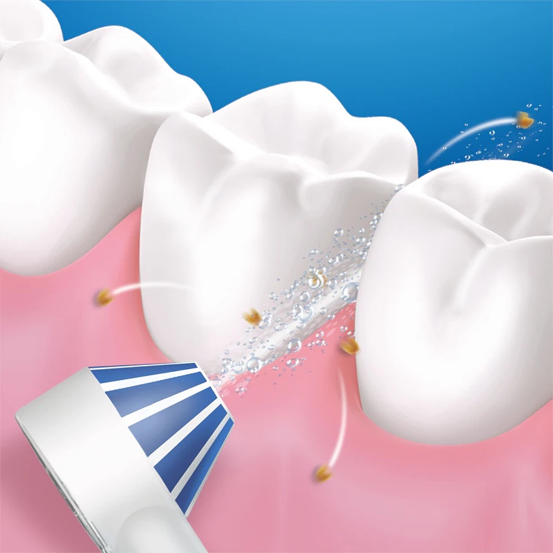 „Oral-B Aquacare 4“ dantų irigatorius