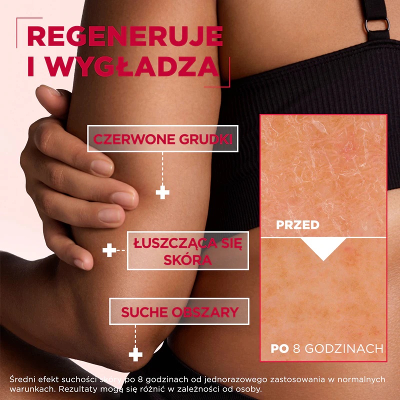 Mixa Mixa Body Care Urea Cica Repair регенеришућа крема за тело за веома суву кожу