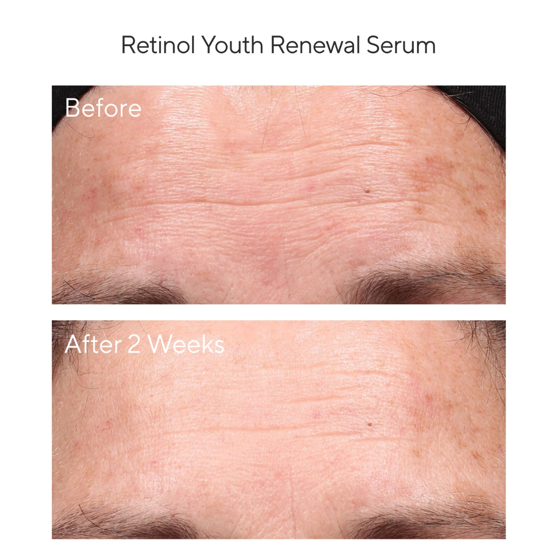 Retinolos Fiatalságmegújító Szérum 30 ml - Murad