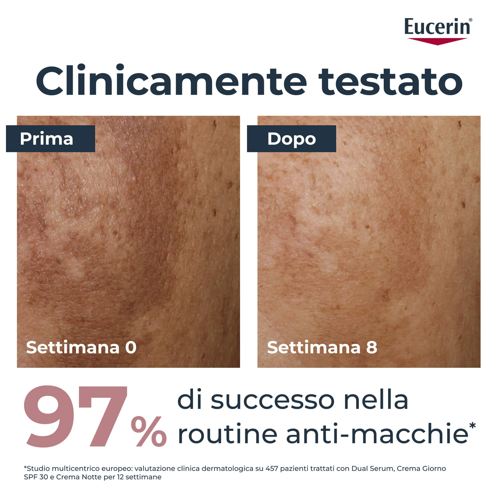 Anti-Pigment Anti-Pigment Giorno SPF30 - Crema viso giorno antimacchie