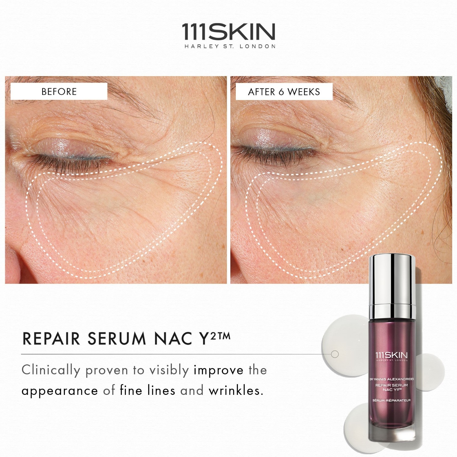 111Skin hidratantni serum NAC Y² obnavljajući serum - 15 ml