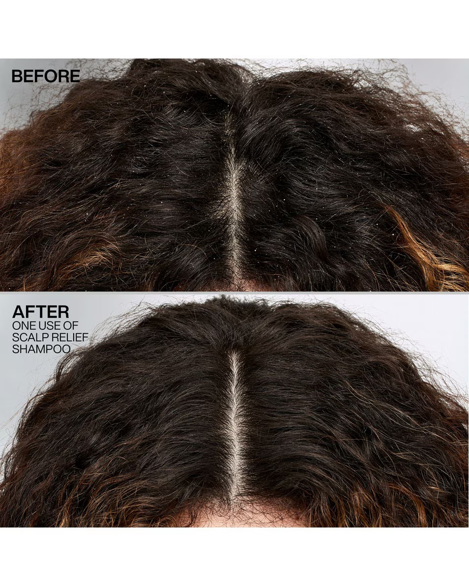 REDKEN Scalp Relief šampón proti lupinám - pre suché vlasy a citlivú pokožku hlavy