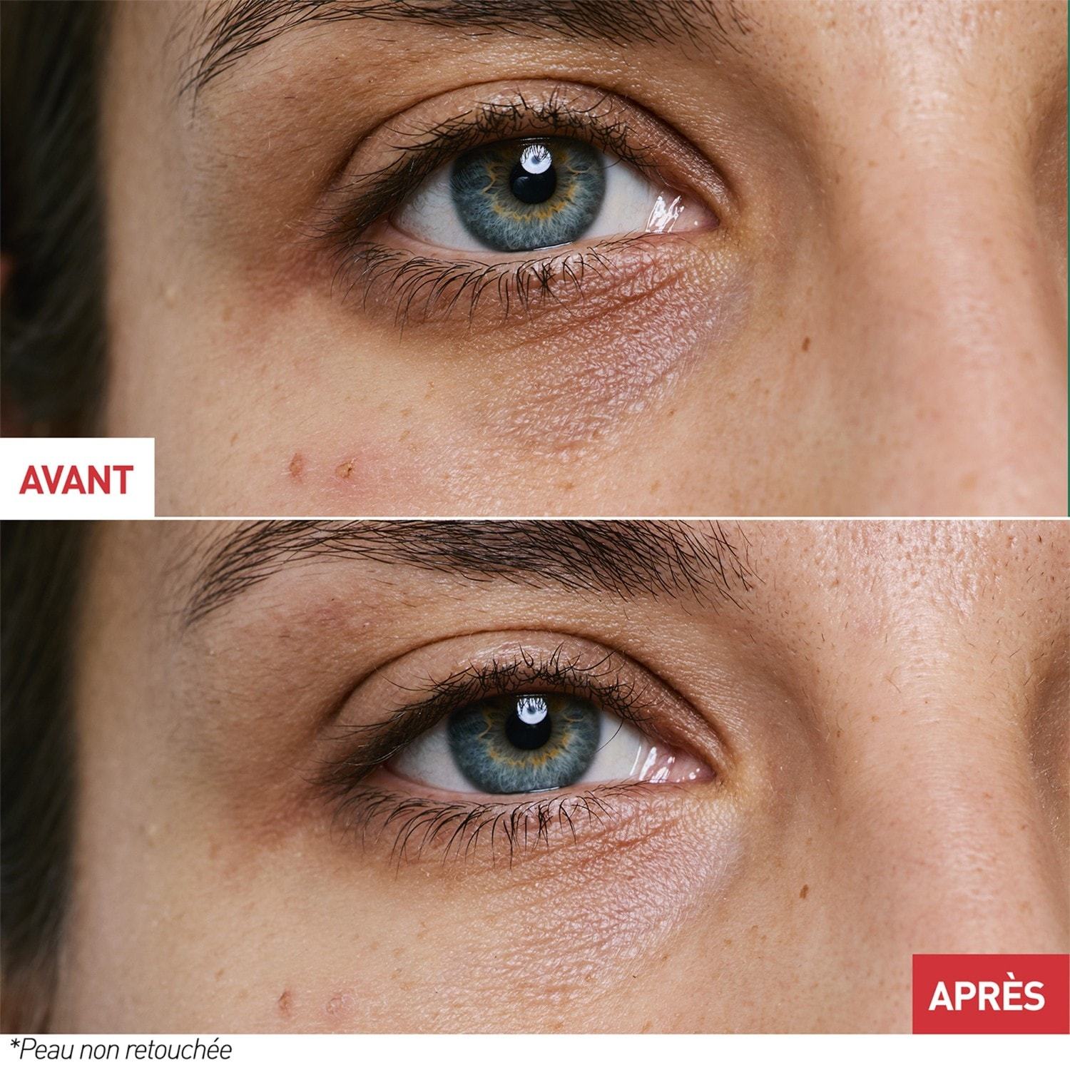 ERBORIAN Augencreme Skin Therapy Eye - 15 ml