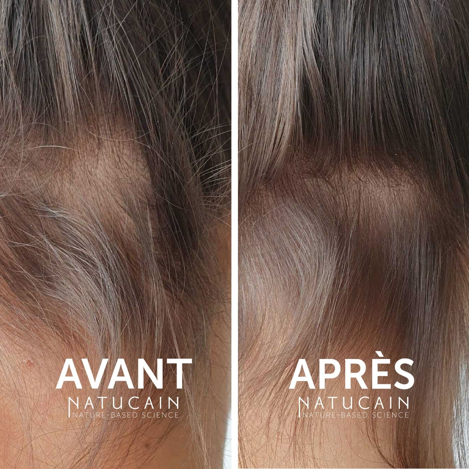 Natucain Natucain Hair Activator
