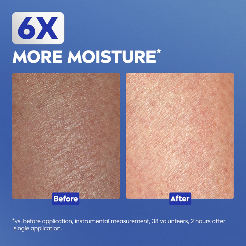 NIVEA Repair & Care Urea Regenerierende Körpercreme für trockene und sehr trockene Haut