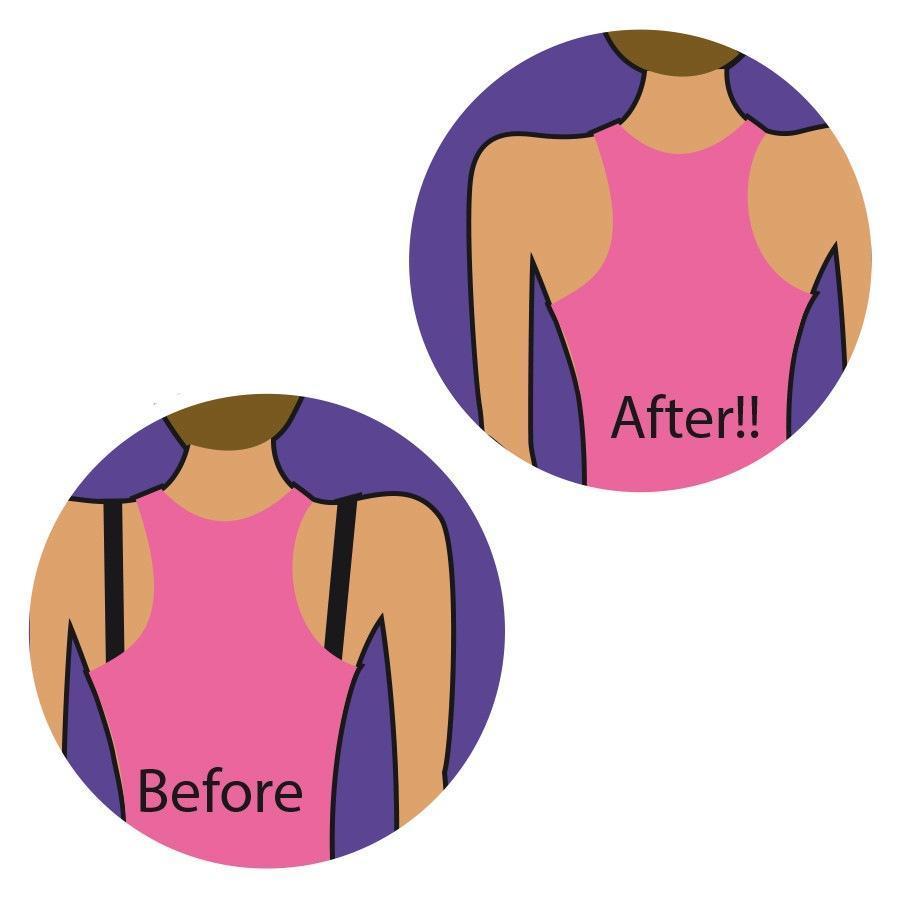 MAGIC Bodyfashion donje rublje Magična kopča - 1 komad