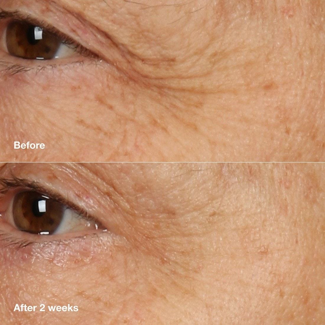 „Clinique Smart Clinical Repair“ naktinis kremas ir kaukė, 50 ml