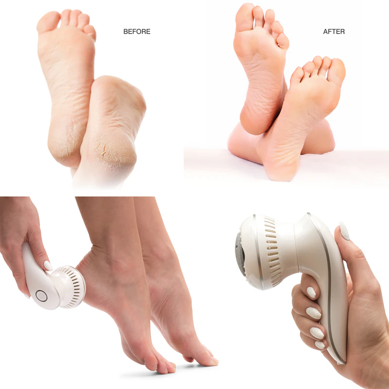 Removedor de Calos RIO Spa Pedi 60 Second