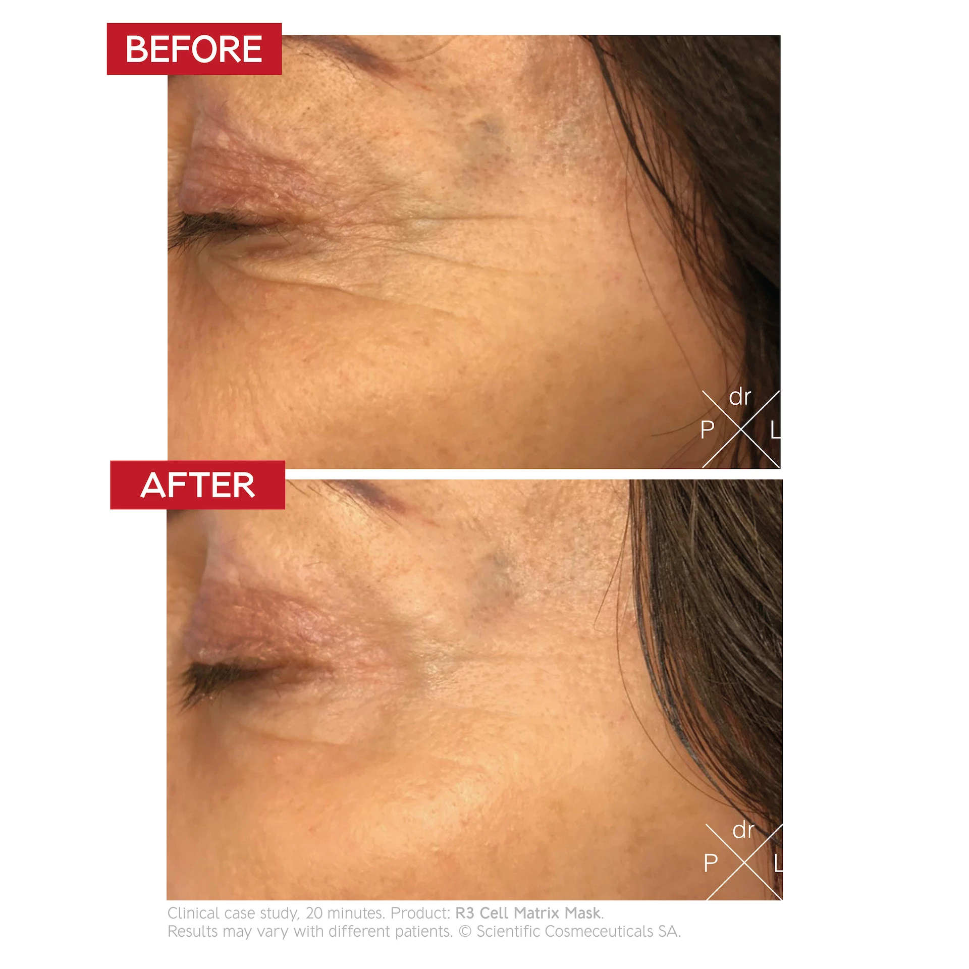R3 Cell Matrix Maszk 50 ml - Dr. LEVY Svájc