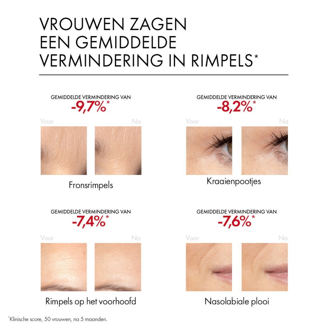 Vichy Anti-Aging Serum Liftactiv Retinol Specialist Serum tegen Diepe Rimpels - 30 ml