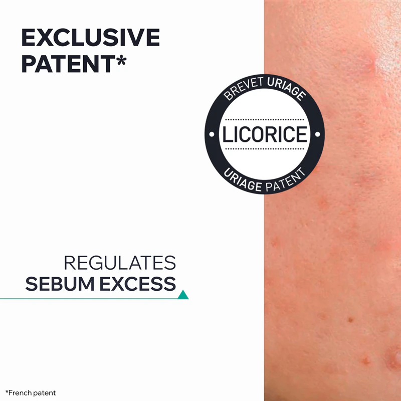Uriage Hyseac SOS Gel Secativo, gel tópico para acne e imperfeições da pele.