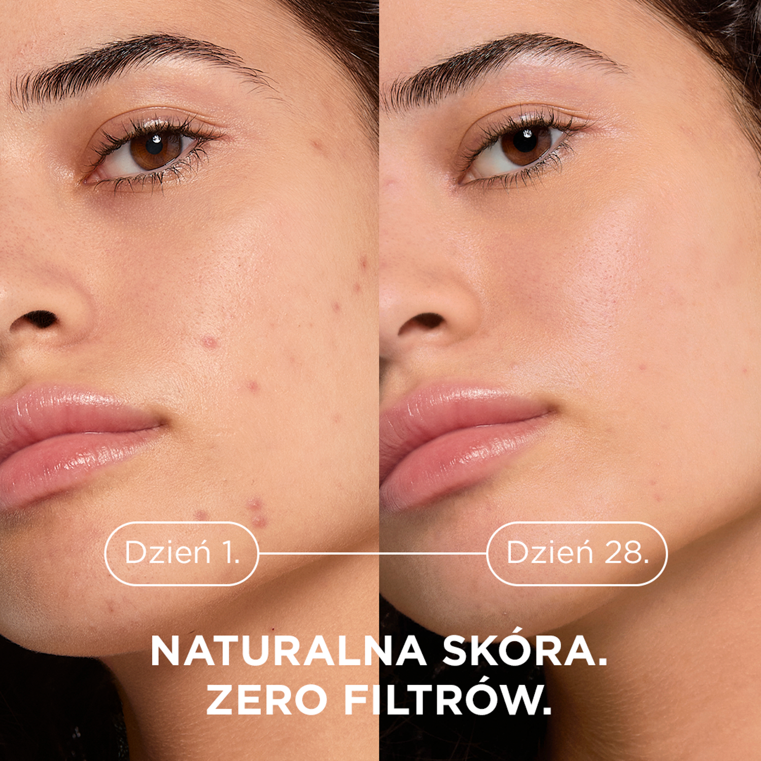 Bioderma Sébium Kerato+