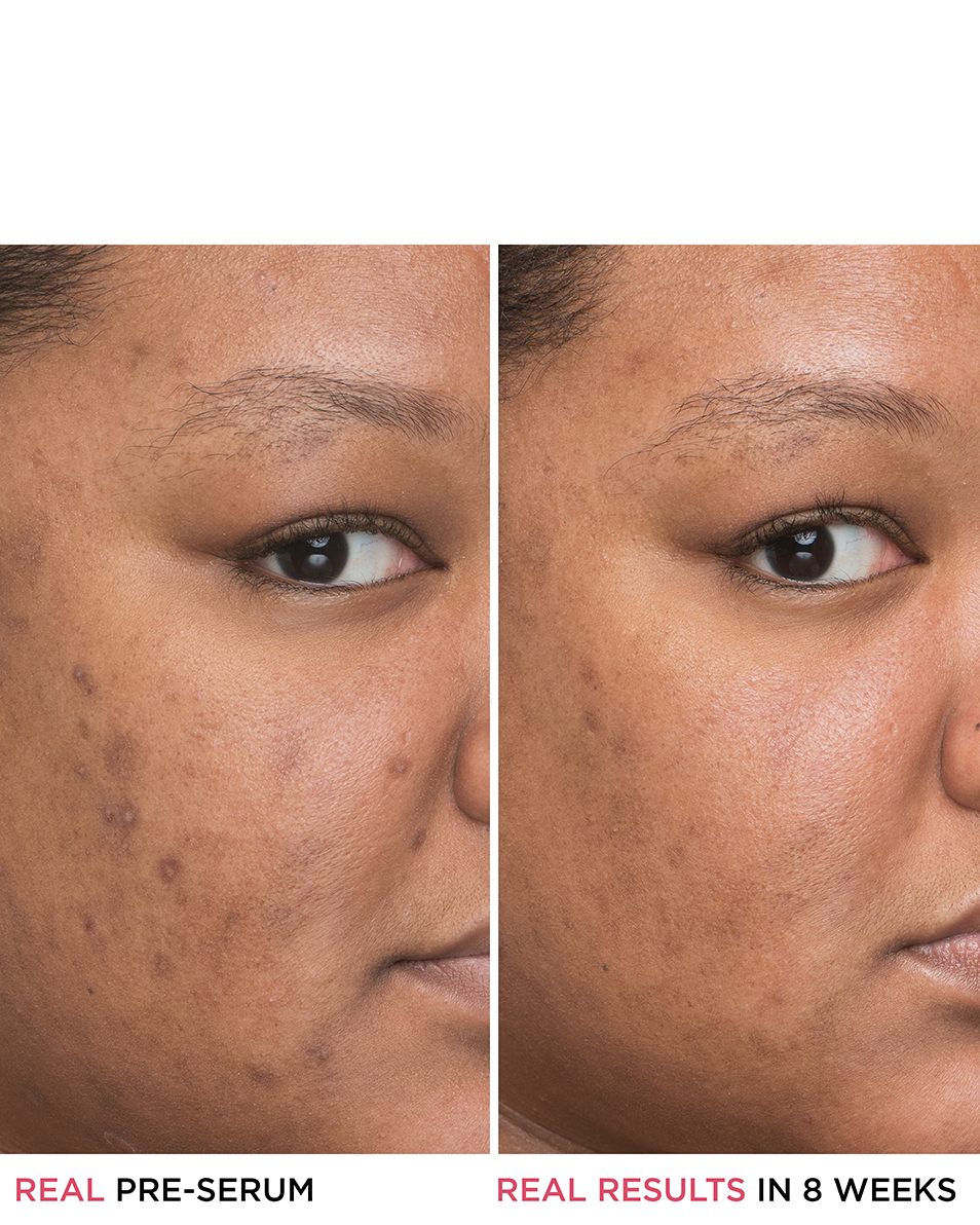 IT COSMETICS BYE BYE SERUM IT BYE BYE DARK SPOTS NIACINAMIDE SERUM