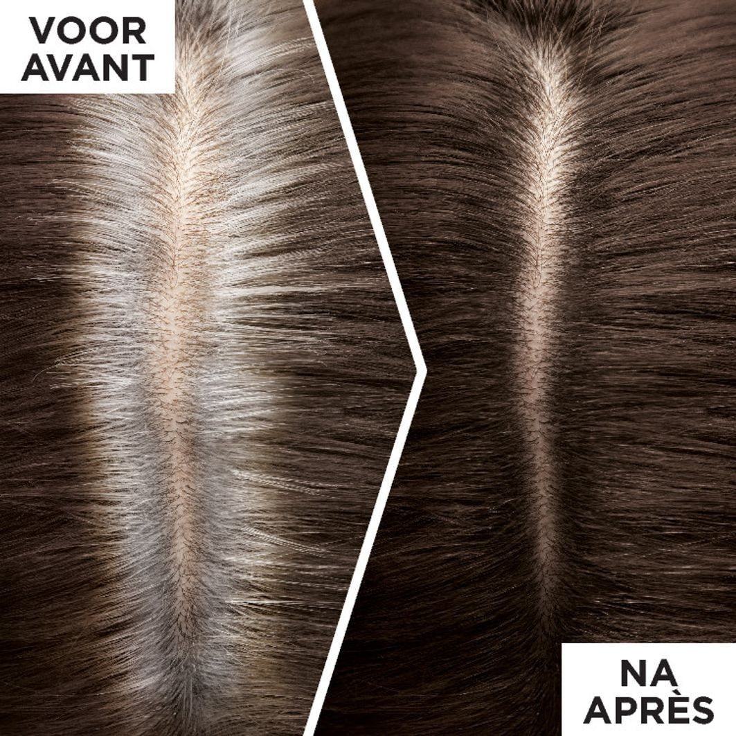 L'Oréal Paris Magic Retouch боја за косу – спреј за освежавање израслине – 75 мл