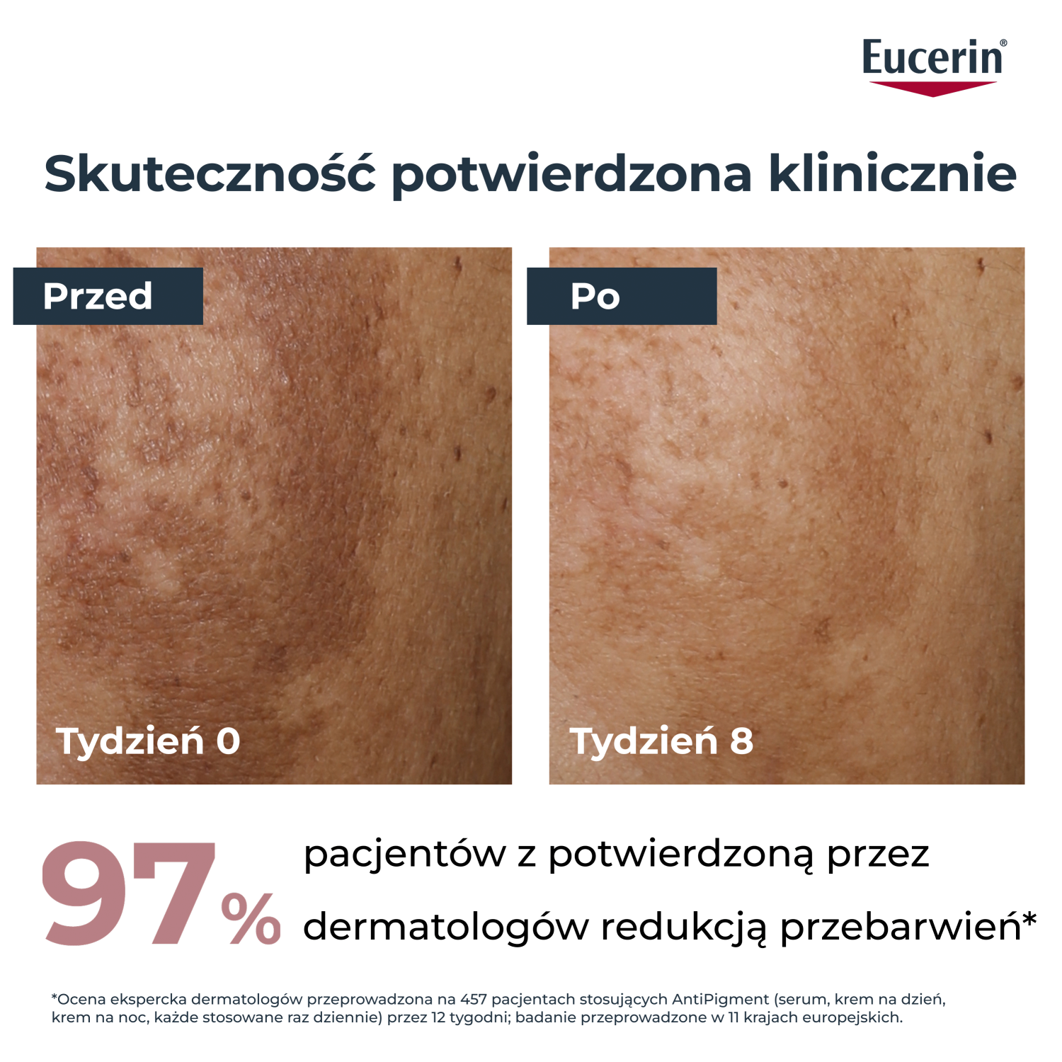 Eucerin antipigmentācijas līdzeklis