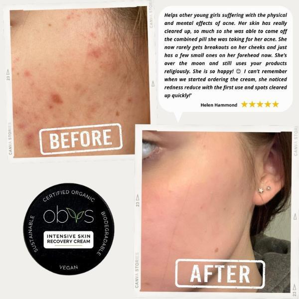 Obvs Skincare интензивна крема за опоравак коже органска 100 мл