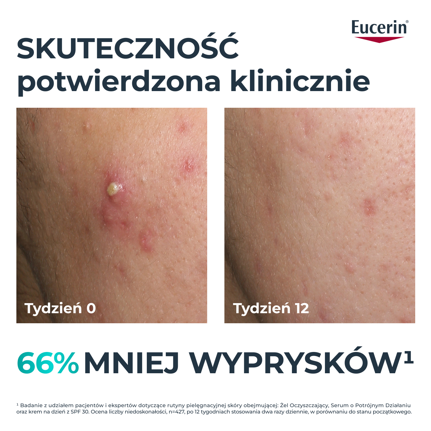 Eucerin DermoPure Clinical